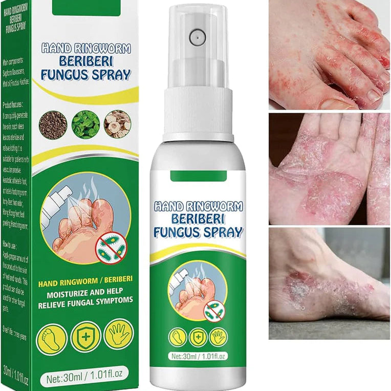 Spray Antifúngico para Pie de Atleta 2x1