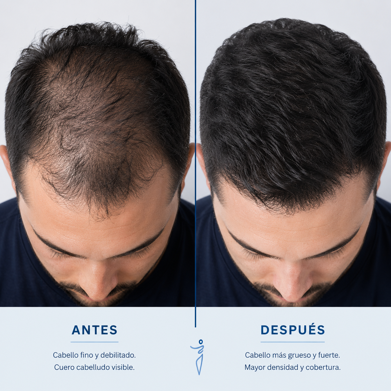 Serum Body Wise / Crecimiento de cabello