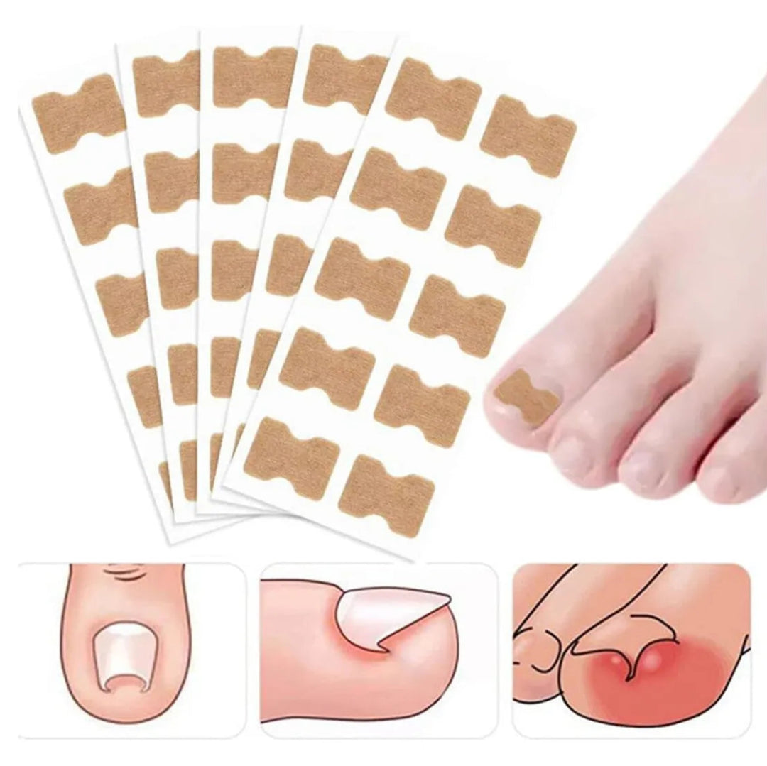 Parche Corrector de Uñas | 100 Parches | 2x1