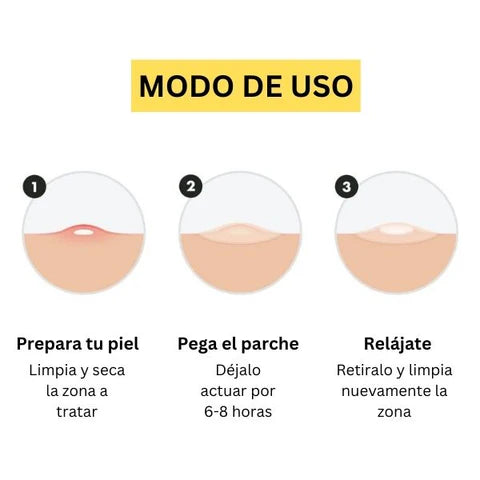 Parches para Tratamiento del Acné 2x1