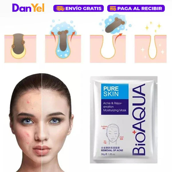 Mascarilla Antiacné - Bioaqua 2x1