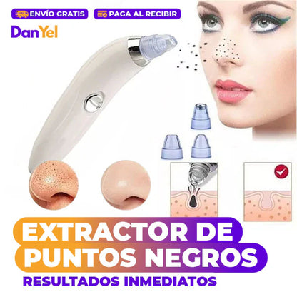Extractor De Puntos Negros