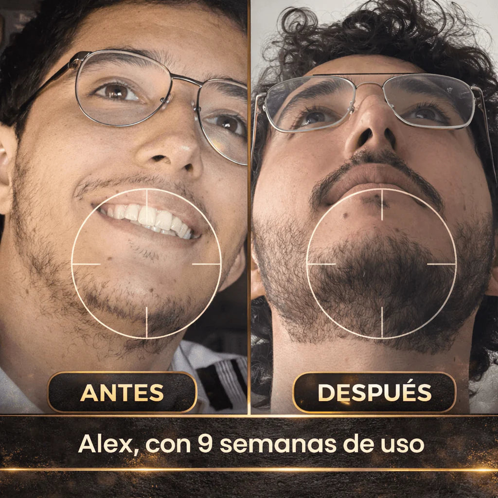 Bálsamo para el Crecimiento de la Barba | Minoxidil al 20%