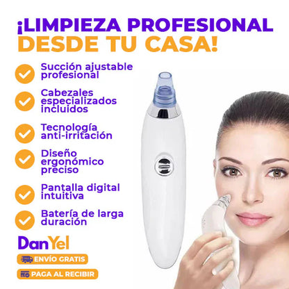 Extractor De Puntos Negros