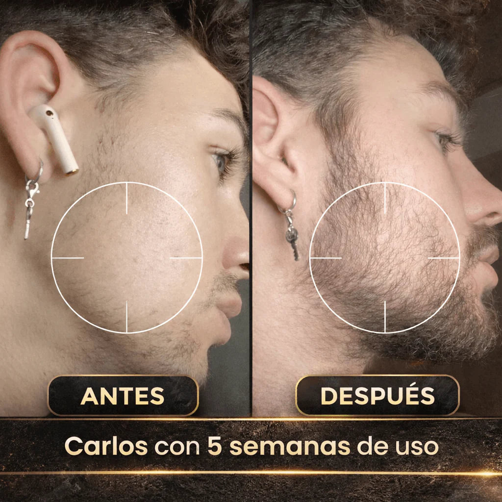 Bálsamo para el Crecimiento de la Barba | Minoxidil al 20%