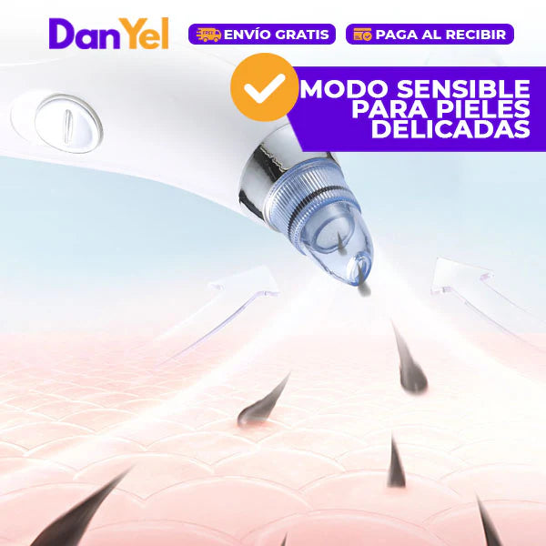 Extractor De Puntos Negros