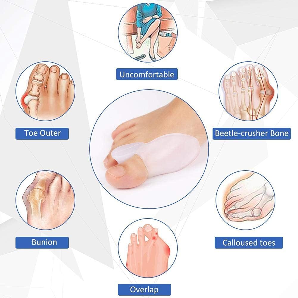 Separador de Dedos de Gel para Juanetes 2X1