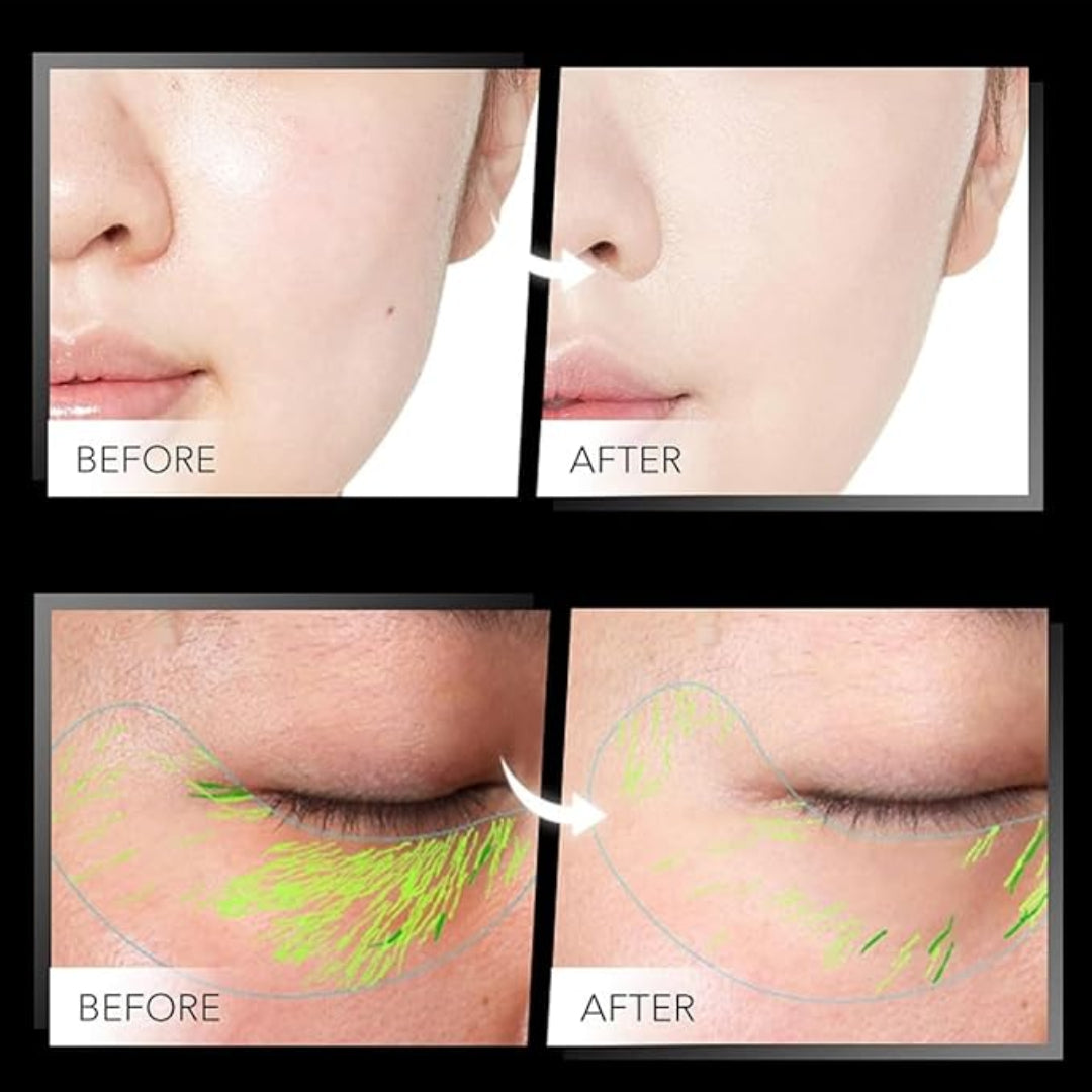 Masajeador Facial | Skintouch