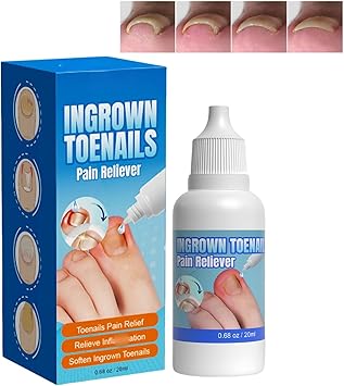 Gotas para Hongos y Uñeros | Tratamiento Rápido y Efectivo
