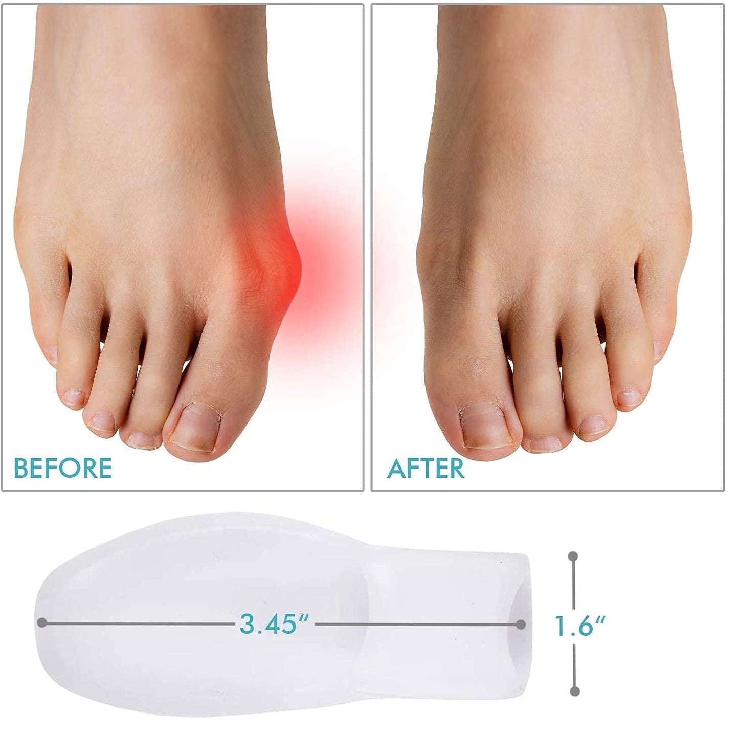 Separador de Dedos de Gel para Juanetes 2X1