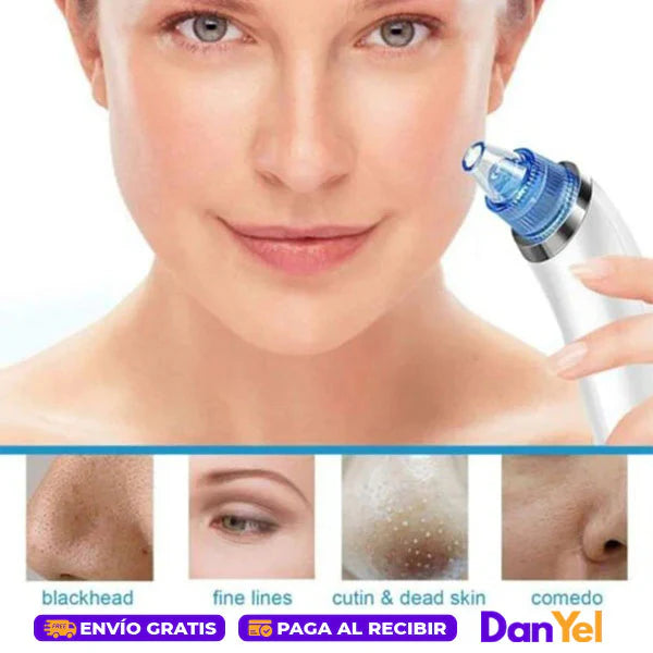 Extractor De Puntos Negros