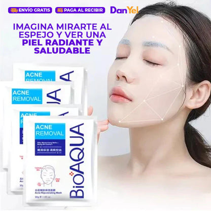 Mascarilla Antiacné - Bioaqua 2x1