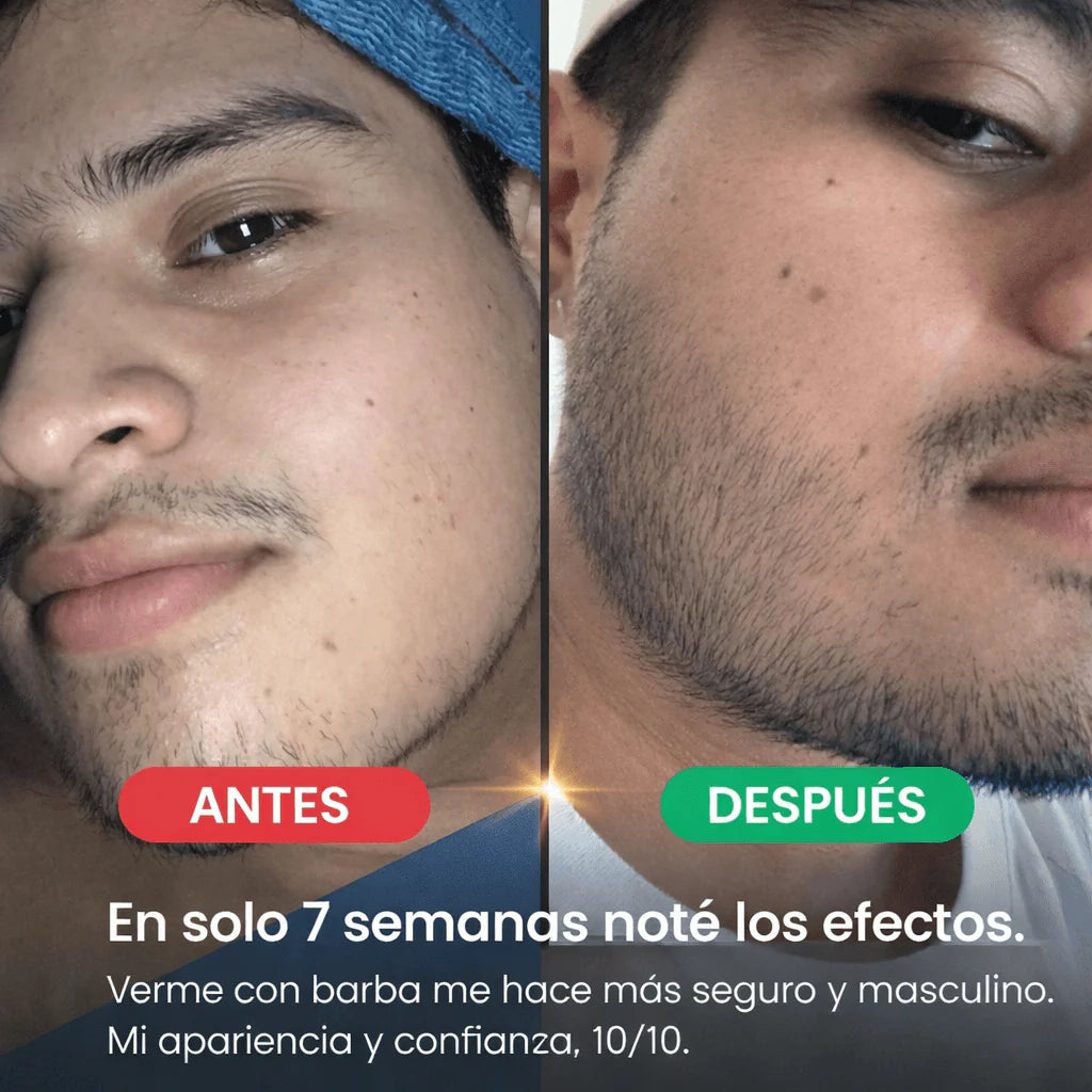 Bálsamo para el Crecimiento de la Barba | Minoxidil al 20%
