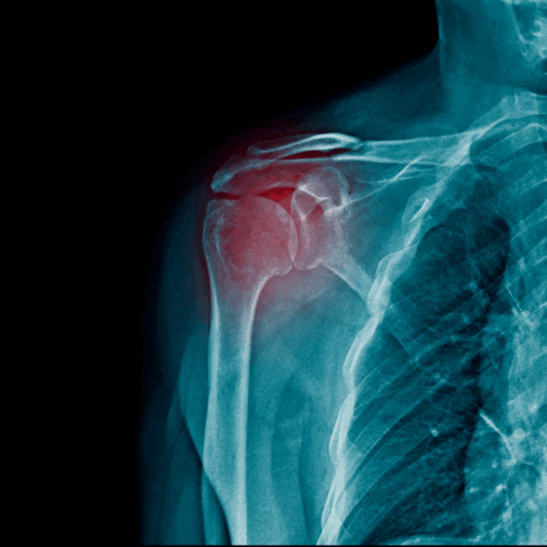Gel Tsunami | Alivio Inmediato para Dolores Musculares