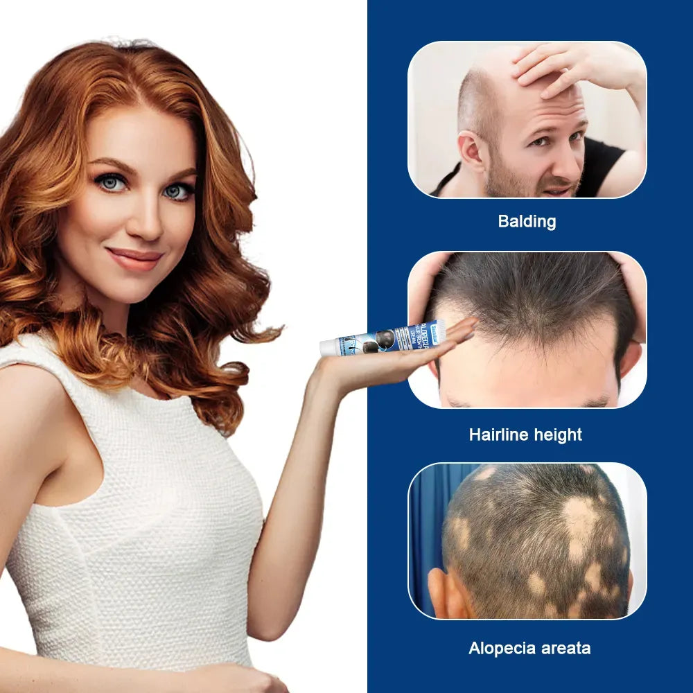 Crema para el Tratamiento de la Alopecia