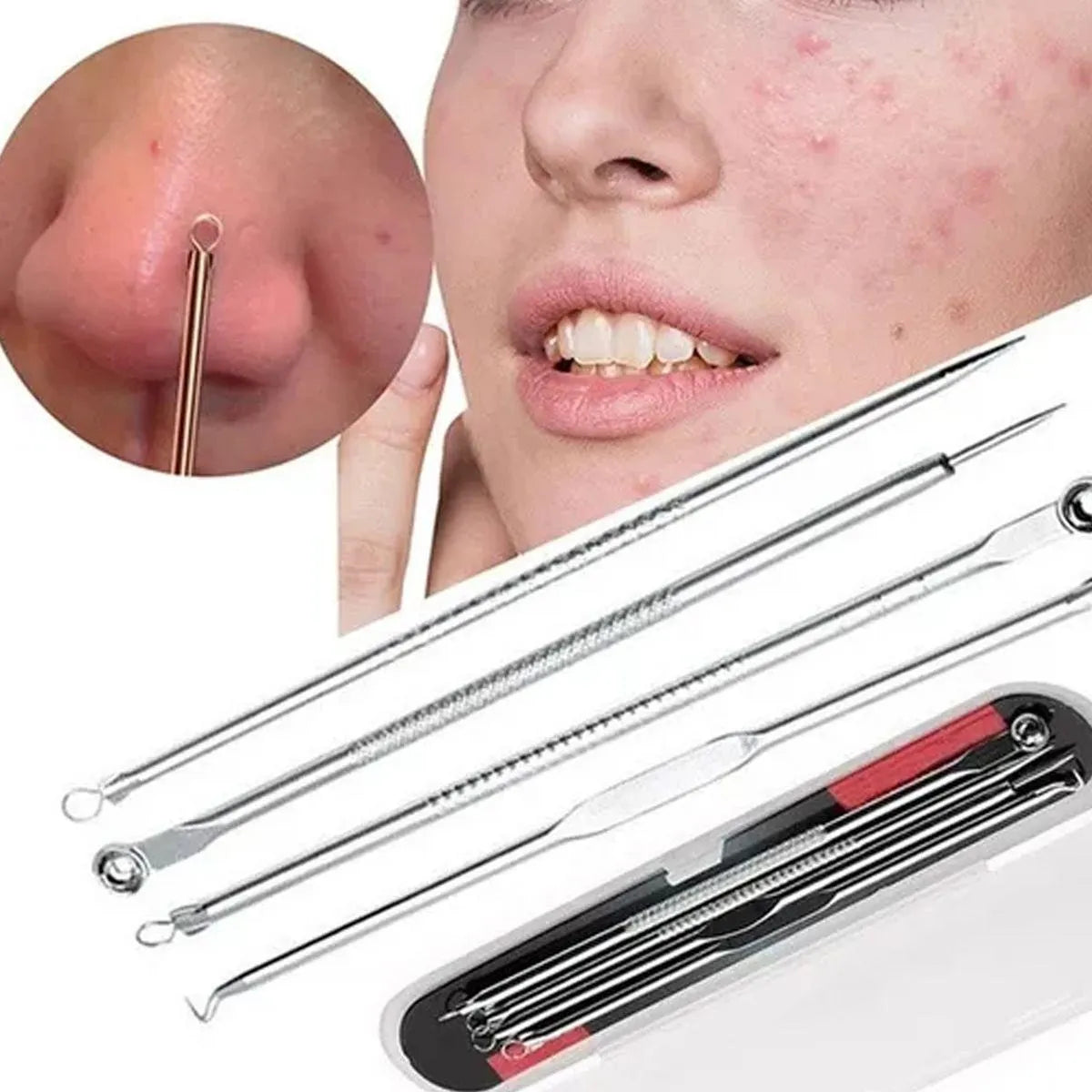 Kit Removedor de Puntos Negros y Espinillas