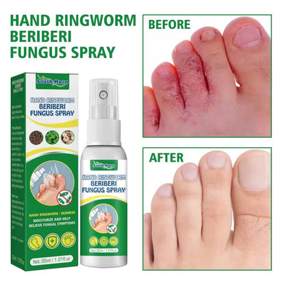 Spray Antifúngico para Pie de Atleta 2x1