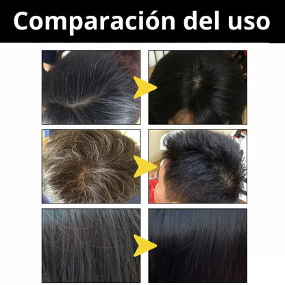 Elimina Canas | Shampoo Negro Instantaneo
