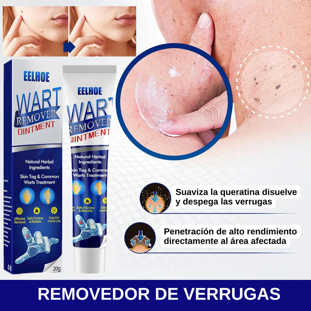 Crema para Eliminas Verrugas