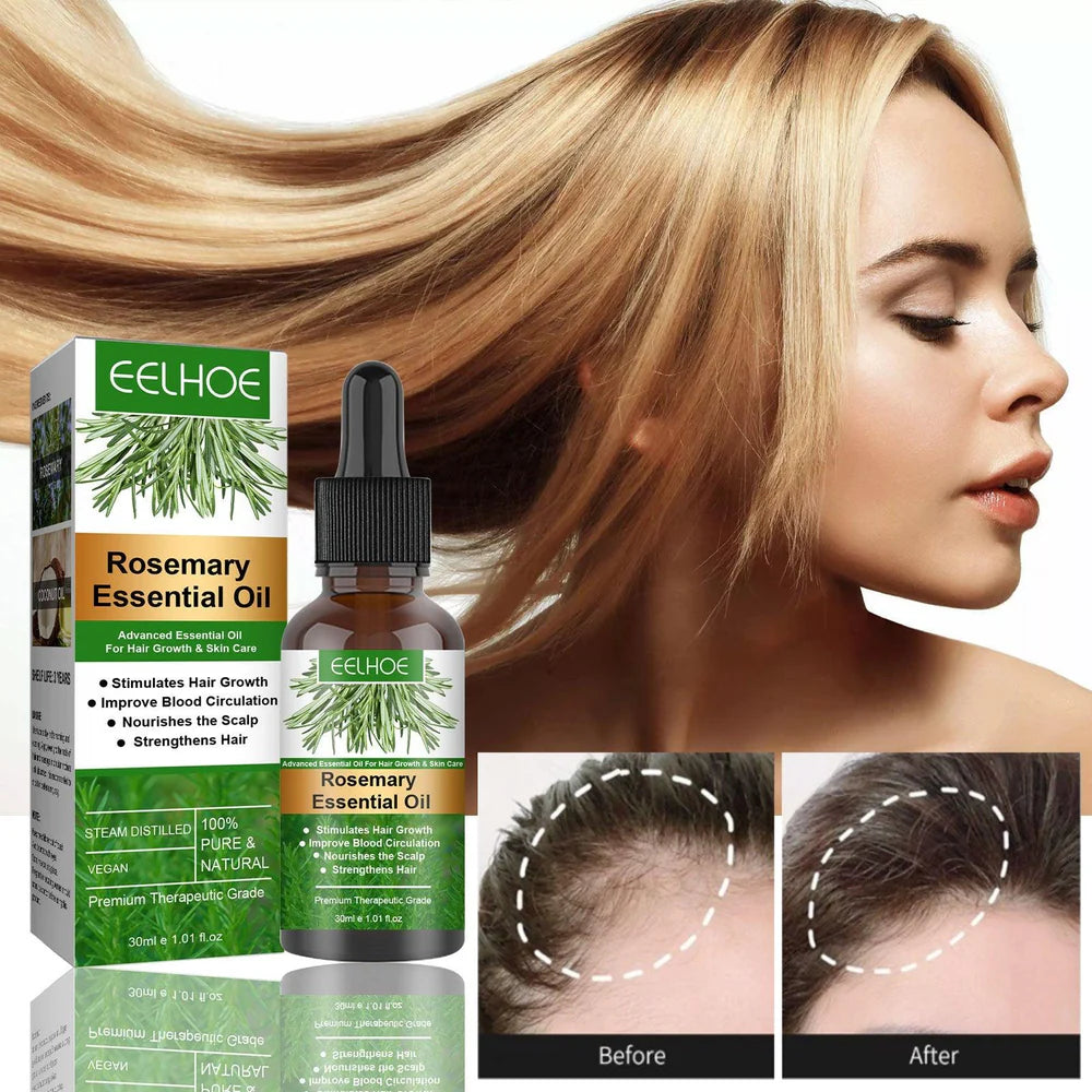 Aceite de Romero para el Crecimiento del Cabello | ELLHOE